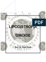 01 Lipodistrofia Ginoide