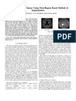 Detection of Brain Tumor Using Otsu-Region Based Method of Segmentation