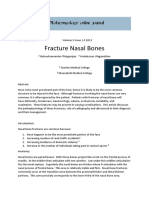 Fracture Nasal Bones PDF