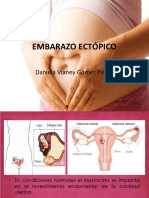 Embarazo Ectópico