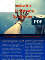 Beckwith Wiedemann Syndrome