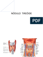 Nódulo Tireóide