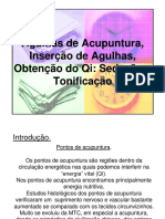 Acupuntura Agulhamento