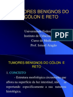 Tumores Benignos de Cólon e Reto