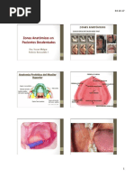 Zonas Anatomicas Remo I