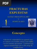 Emergencia FX Expuestas