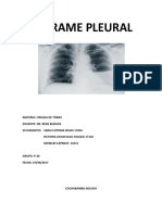 Derrame Pleural