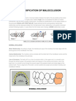 Angle Clasification