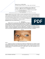 Congenital Cataract-Approach and Management Review