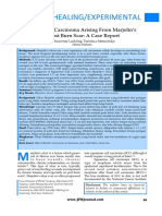 Wound&Healing/Experimental: Squamous Cell Carcinoma Arising From Marjolin's Ulcer Due To Post Burn Scar: A Case Report