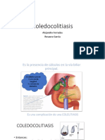 Coledocolitiasis