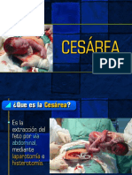 Cesarea