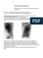 Patrones de Enfermedad Pulmonar