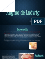 Angina de Ludwing