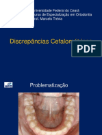 Discrepâncias Cefalométricas PDF