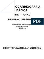 Ekg Basico. Hipertrofias. DR Gutierrez Zerpa