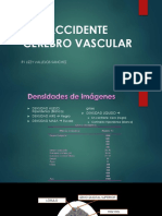 Accidente Cerebro Vascular Tem