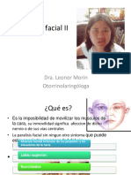 Parálisis Facial II2