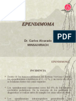 Ependimoma