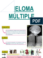 Mieloma Multiple