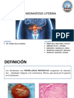 Miomatosis Uterina