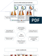 Patogenia de La Enfermedad Periodontal