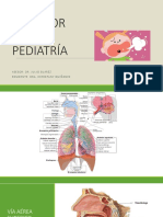 Estridor en Pediatría