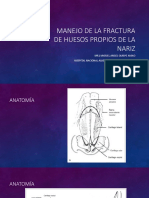 Manejo de La Fractura de Huesos Propios de La Nariz