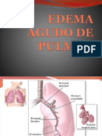 Edema Agudo de Pulmon