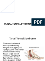 Tarsal Tunnel Syndrome - MP