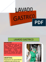 Lavado Gastrico