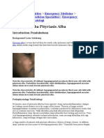 Pityriasis Alba Pityriasis Alba