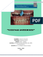 Corona Anterior