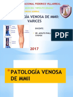 Varices de Miembros Inferiores