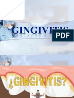 Gingivitis