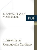 Bloqueo Auriculo Ventricular