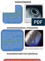 Esofagostomiasis