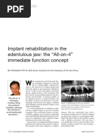 Implant Rehabilitation in The Edentulous Jaw: The "All-On-4" Immediate Function Concept