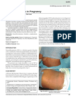 Neurofibromatosis in Pregnancy