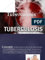 Tuberculosis 