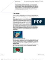 Case Report: ISPUB - An Unusual Case of Unicystic Ameloblastoma Involvi..