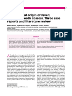 An Unnoticed Origin of Fever: Periapical Tooth Abscess. Three Case Reports and Literature Review