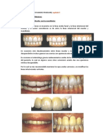 Seminario Partes