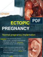 Shubrat Singh: Ectopic