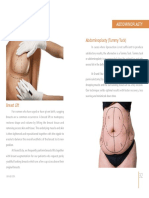 GrandEsta - Breast Lift PDF