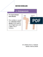 Bones Disease: By: Jennica Kyle D. Tubigan Grade 4-Matulungin