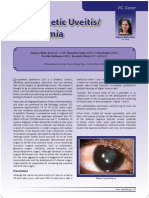 Sympathetic Uveitis/ Ophthalmia: PG Corner