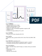 Ecg ...