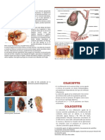 Colecistitis