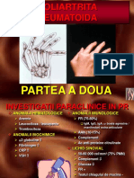 Poliartrita Reumatoida: Partea A Doua